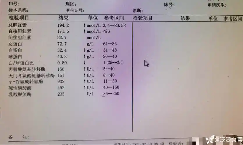 明显黄疸,原因何为? - 丁香园论坛