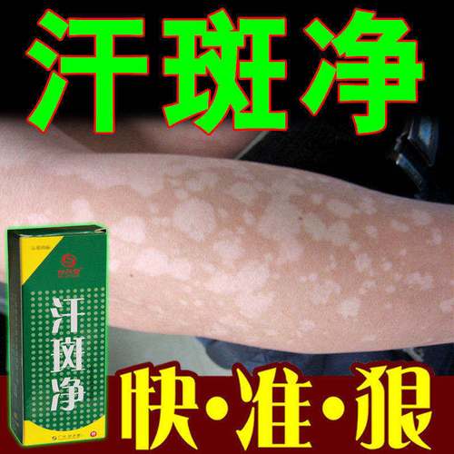 汗斑专用汗斑净皮肤日本汗斑露汉斑专用药灵花斑膏正品喷剂买2送1