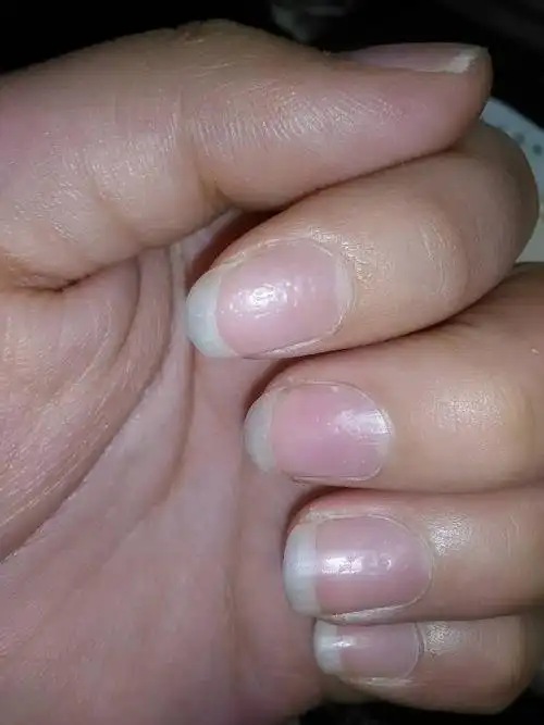 为什么指甲会凹凸不平的(指甲表面凹凸不平是身体透露出的健康信息)