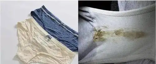 加上一般穿了一天的内内会沾上尿液,分泌物等等,容易滋养细 菌,从而