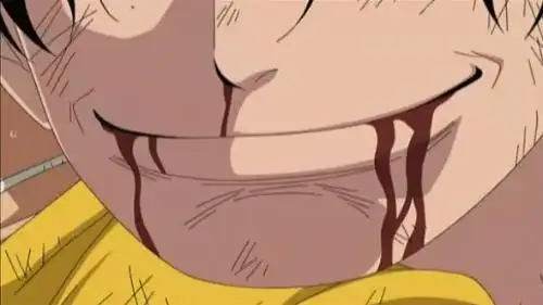 我要想要艾斯死时的那张图片.那张微笑的死去的图片