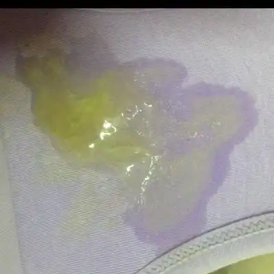 怀孕39周,今早突然流出东西来,这是羊水吗?