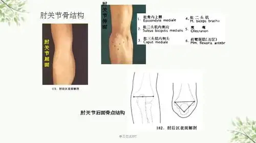 肱骨外上髁炎课件