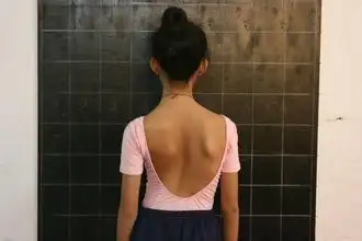 明辨脊柱侧凸的症状,早发现早治疗