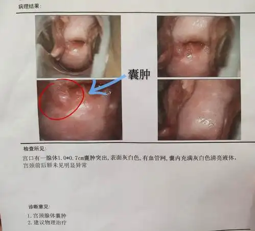 呵护女性健康,促进家庭和谐