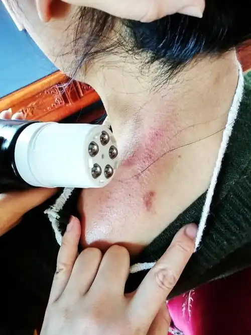 康正药业|刮痧解决"职业病",办公室白领们刮痧注意这几个部位