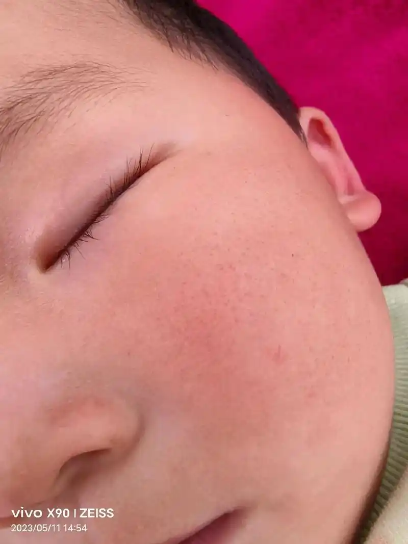 两岁两三个月的宝宝不应该是婴儿肌肤吗?