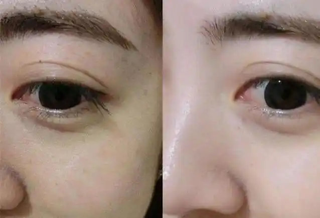 40岁的女人,不想变黄脸婆!早晚吃一勺"它",能美容养颜!年轻二十岁!