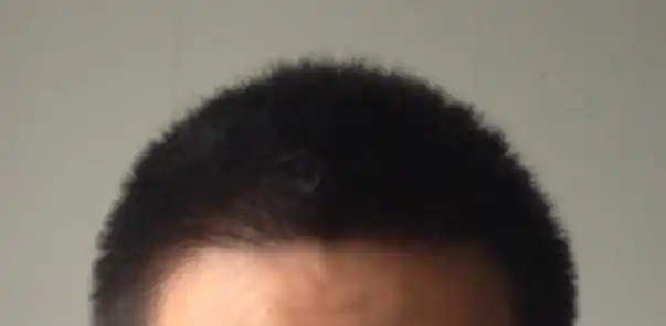 毛寸和毛碎的区别