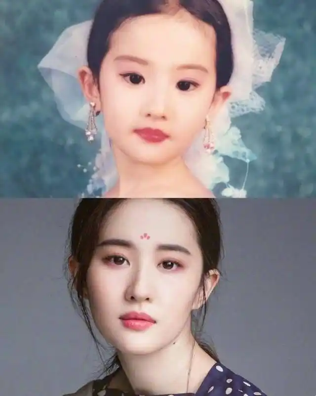 刘亦菲的童年照,怎么鼻子上少了个痣,这个痣是什么时候长的