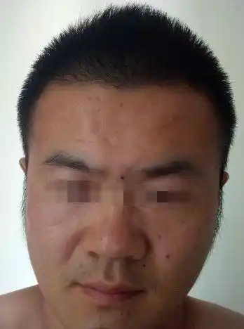 这种面相的人心胸狭隘肚量小切记不可深交