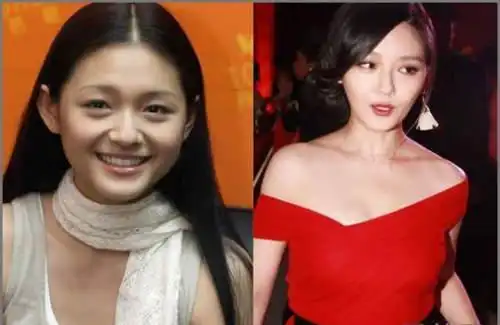 李小璐大s女星整容过度微微一笑很尴尬