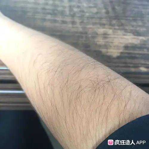 怀孕初期肚子上长毛毛就是男宝吗?