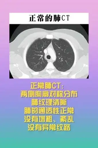 图片1:正常肺ct :两侧胸廓对称分布,肺纹理清晰,肺的通透 - 抖音