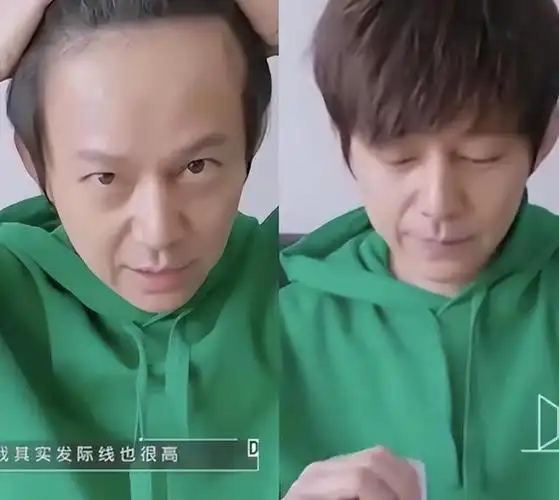 看似帅气实则脱发严重的男星沙溢何炅彭于晏个个心酸又好笑