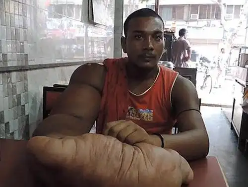 世界上最大的手男子手长近半米重达40多斤