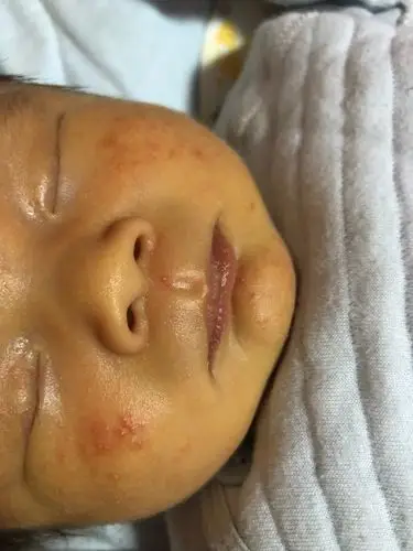 8楼 这是脂肪粒吗