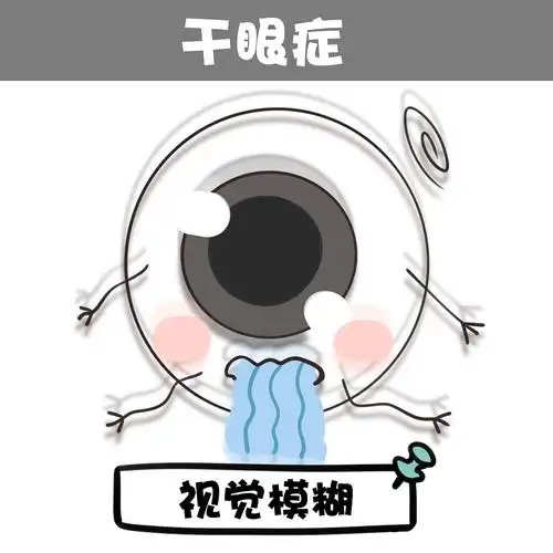 干眼症症状