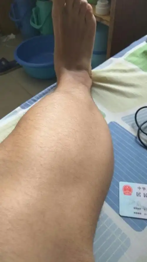 小腿肌肉这么发达怎么办啊,瘦不下来,越来越粗