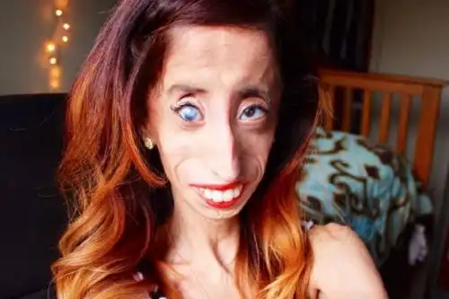 这位年仅26岁的女性被冠以"全世界最丑陋女人"之名