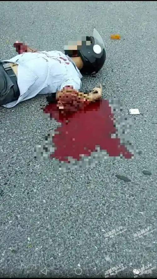西塘桥发生惨烈车祸摩托车驾驶员手臂被折断皮开肉绽