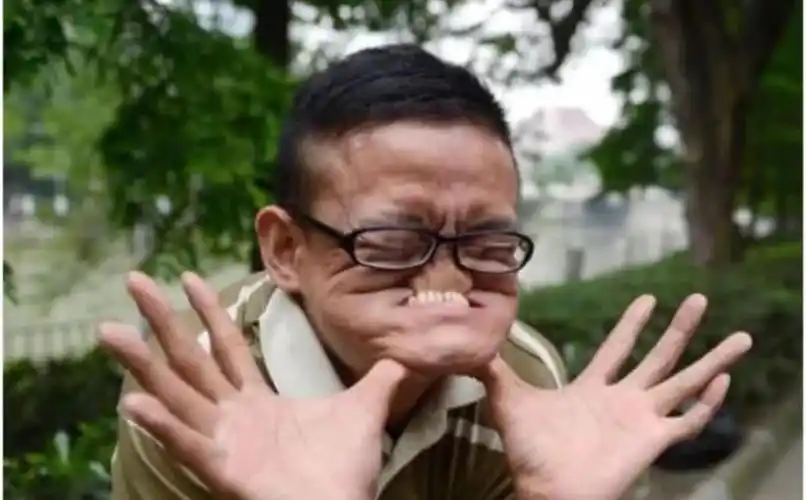 奇葩的吉尼斯纪录: 世界上最丑的人?小女孩5岁成为最年轻妈妈