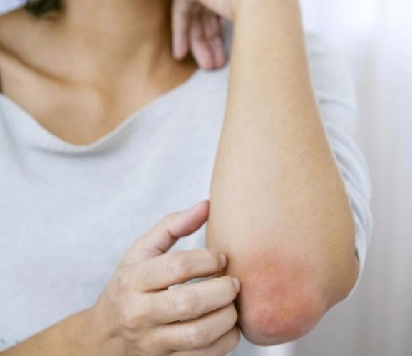 身上有癌,皮肤先知,皮肤有3种"变化",可能肝癌来访,莫忽视