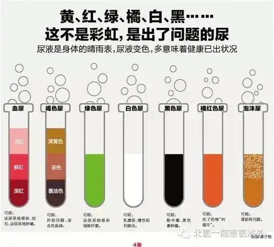 随着饮水量可变浅,异常的尿液颜色也有很多,如红色 绿色 褐色 紫色