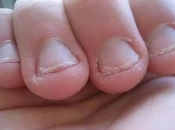 孩子咬指甲总咬出血?并非缺维生素这么简单,这4个原因是关键
