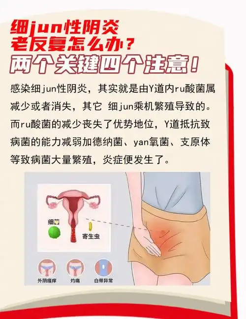 细jun性阴炎老反复认准2个关键4个注意