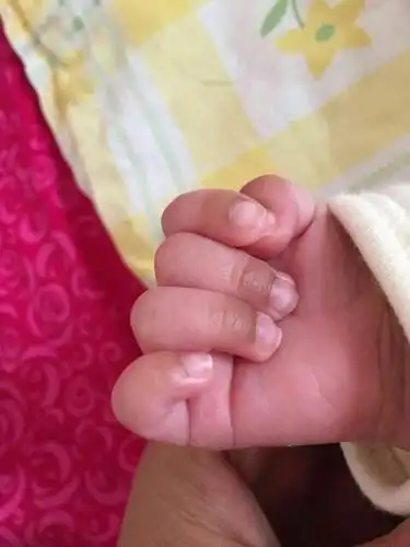 30天的小孩手指末端发黑是什么原因啊?