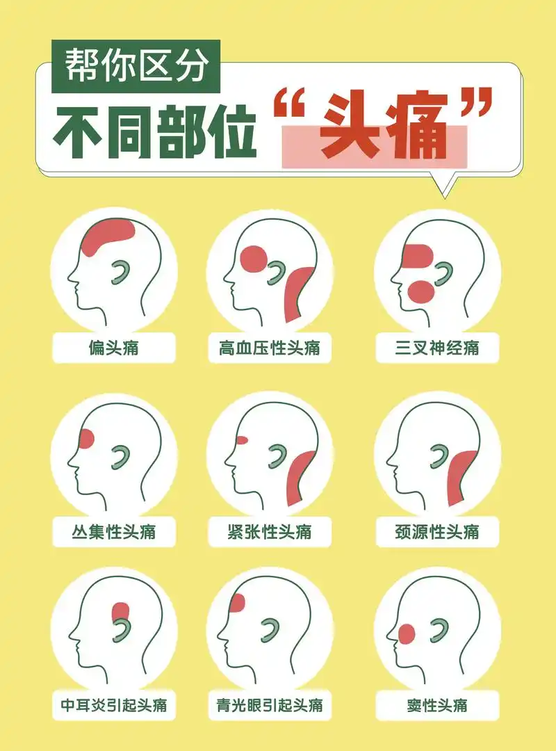 头痛的位置,感觉,并发症不同, - 抖音