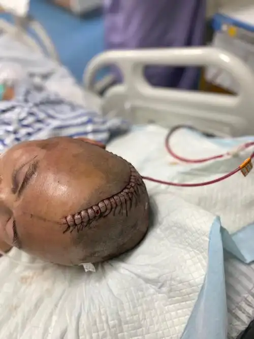 看到这长长的刀口,你也许很害怕吧!