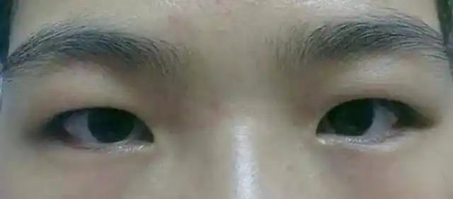 眼睛无神不好看是单眼皮造成的?单眼皮表示:此锅不背!