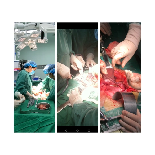 三院妇产科——为女人健康保驾护航,记一例成功的宫颈癌手术