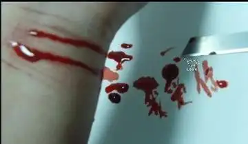 不痛苦的自残 自残社保