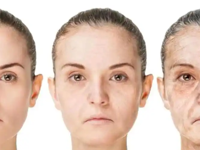 面部初老症应该是很多女生比较害怕的问题了吧,无论五官再漂亮,一张"