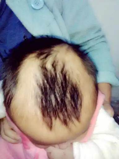宝宝四个月了,头顶发型长成这样,后脑勺头发松软又短,只有这些地方有