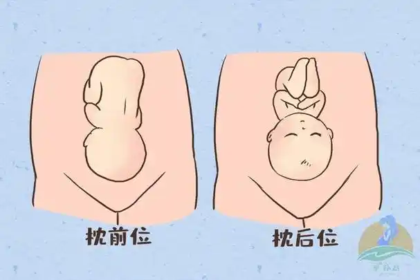 头位胎儿图