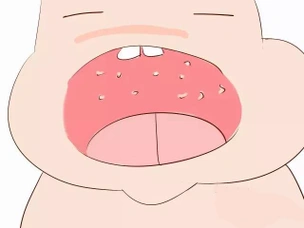 一,上皮珠,马牙,螳螂嘴