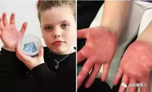 这款网红玩具有毒已令3人丧命快别再让孩子玩了