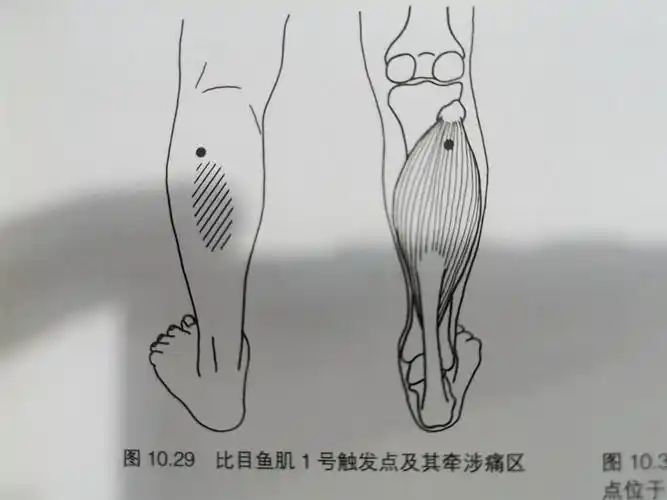 比目鱼肌,它就长在小腿的后面