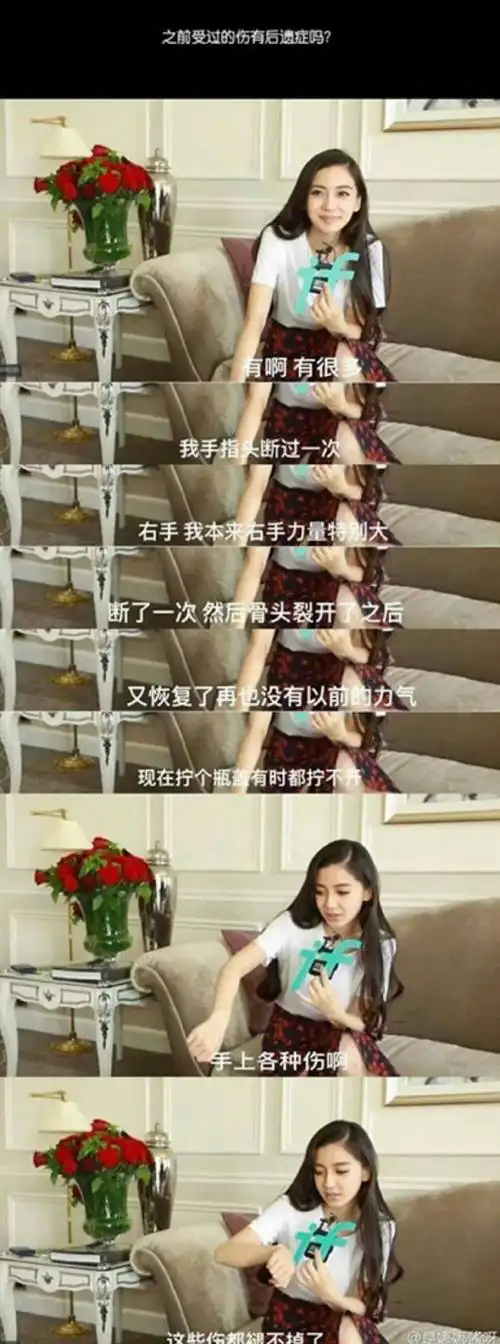 李晨杨颖##杨颖李晨