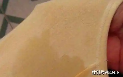 分泌物多假性宫缩见红见羊水等如何分辨是否真临产呢