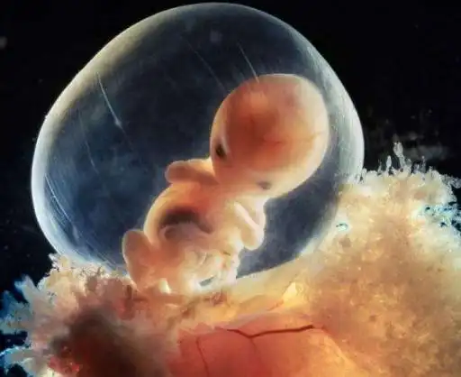 怀孕5-8周胎儿像"人"了,孕妇妊娠反应大,要避免胎儿"畸形"