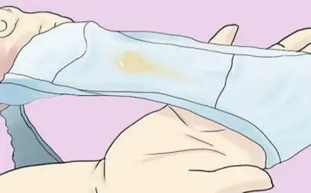 白带像鼻涕一样是怎么回事?摊上事了!赶紧对照自查!