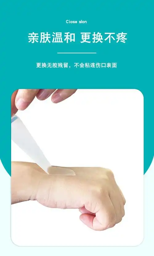 妥能水胶体敷料伤口再生贴医用透明敷贴人工皮祛痘痘贴吸脓 e117网红