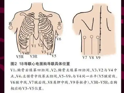 年轻护士心电图讲课