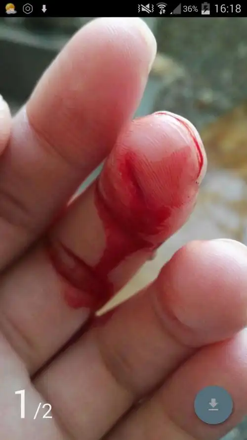 如何评价提问【 切菜被刀割了一个小口子,去医院包扎下要 190,这收费