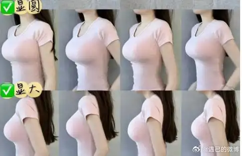 身材管理##假体隆胸##脂肪隆胸##自体脂肪填充